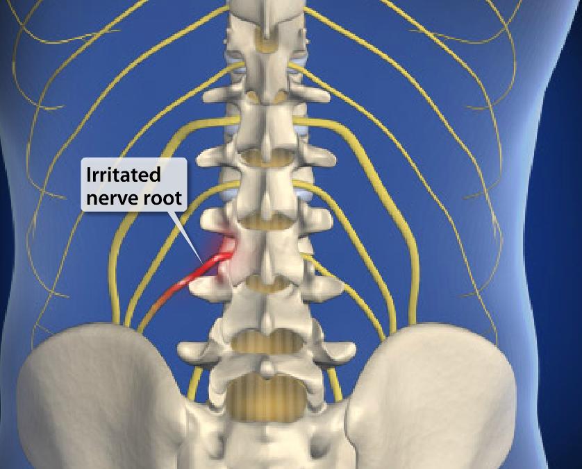 Leg Pain Image