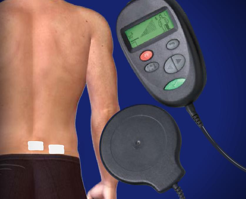 Spinal Cord Stimulator Trial